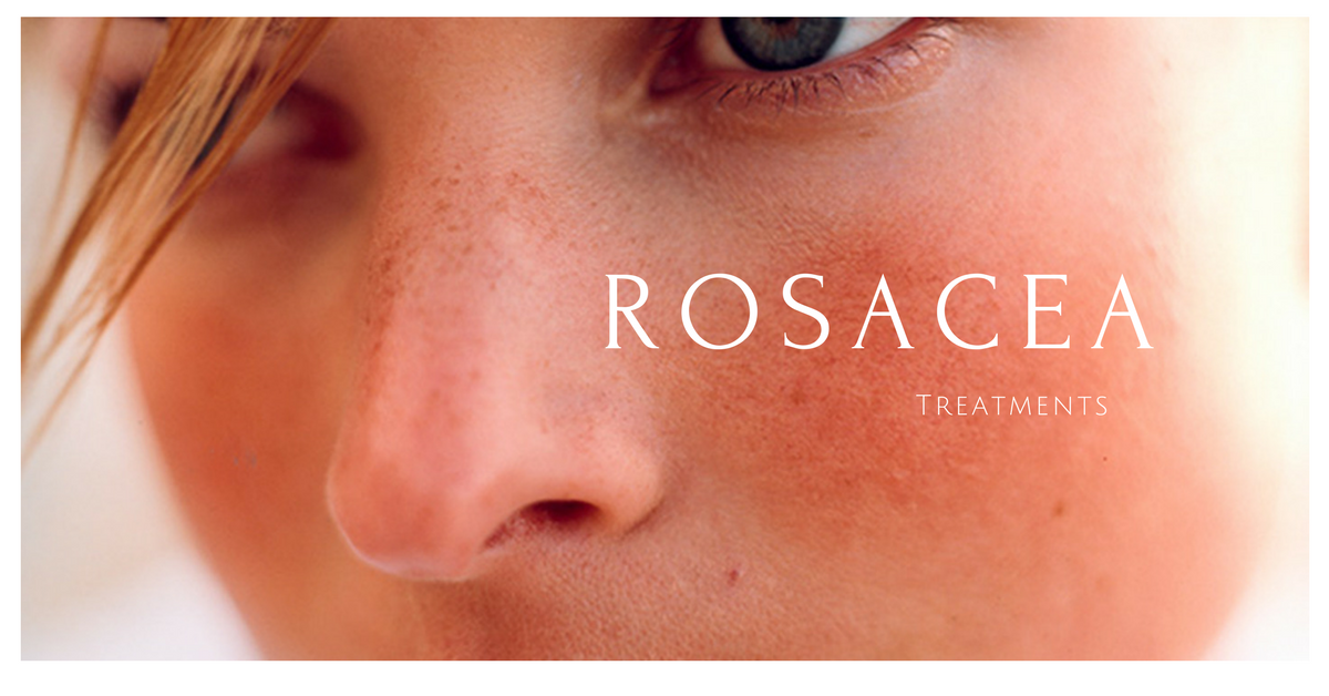 ROSACEA (REDNESS)